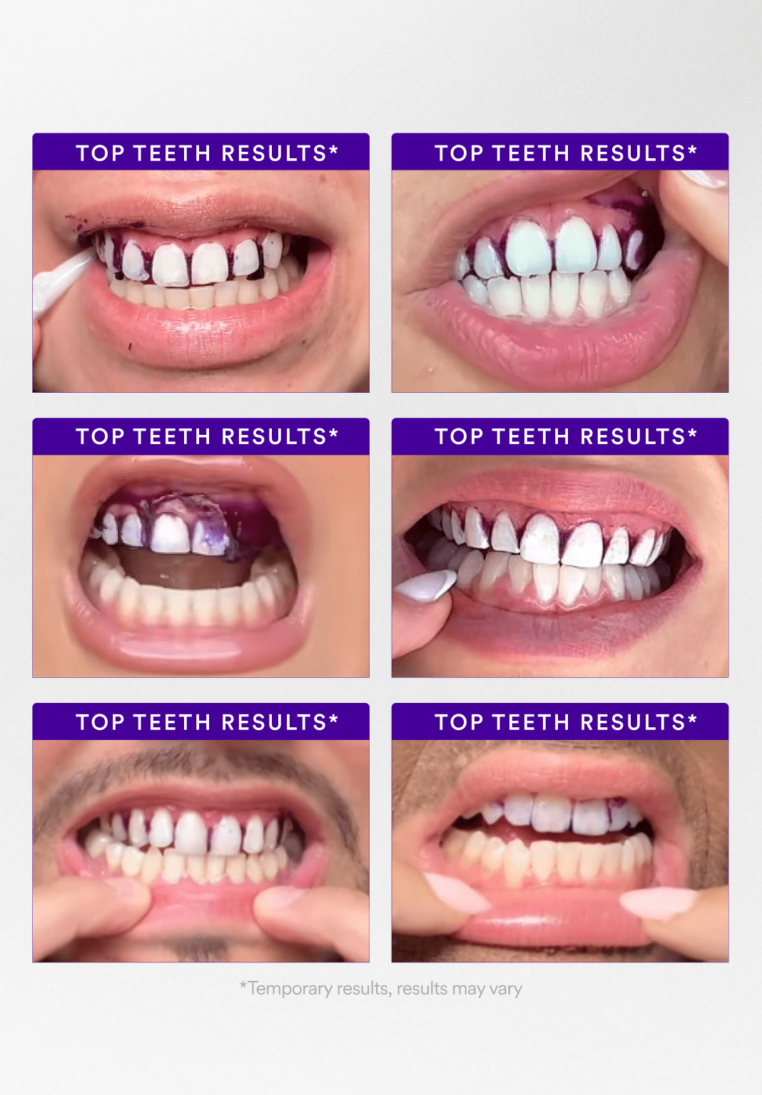 Starter Bundle